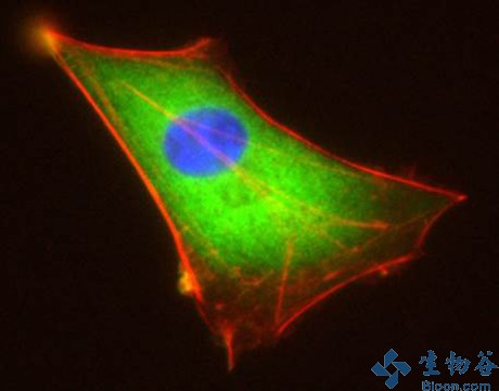 u87胶质母细胞瘤细胞的荧光染色图像,组织型转谷氨酰胺酶(绿色),肌动