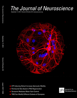 journal of neuroscience:揭开帕金森的神秘面纱