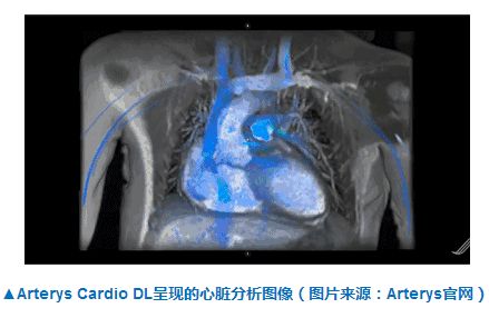 取代医生？FDA批准人工智能分析心脏图像