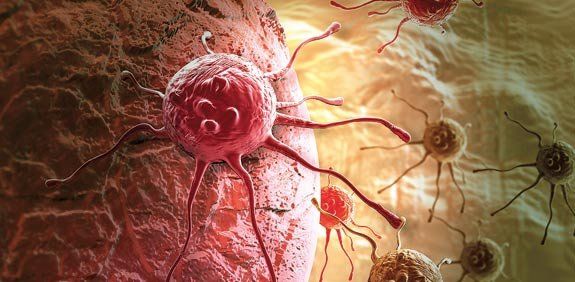 Targovax肿瘤免疫疗法治疗胰腺癌患者临床早期研究现曙光进展和机遇
