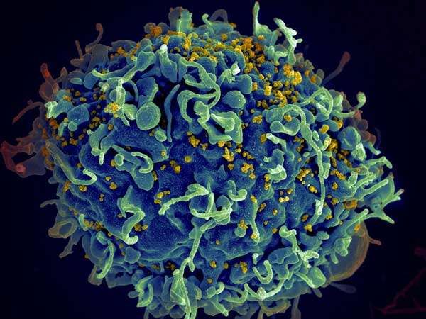 PLoS Pathog：震惊！正常成纤维细胞竟会帮助HIV感染免疫细胞