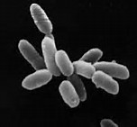 西班牙学者揭示抗生素对肠道菌群及代谢影响巨大