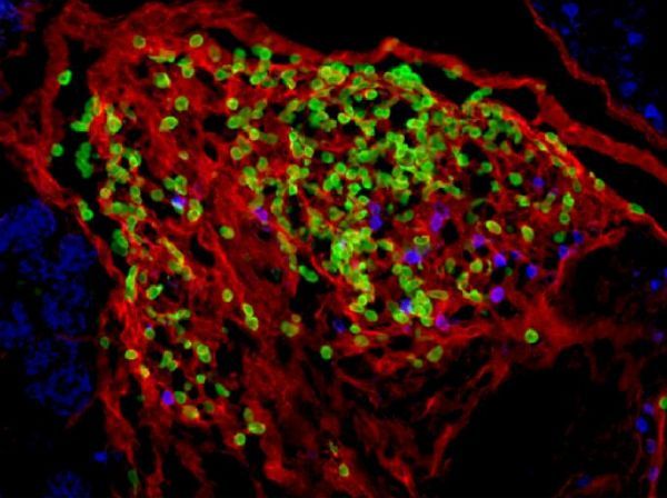 Immunity：揭示肥胖阻断机体护卫免疫细胞发挥正常功能的分子机理