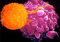 抗癌新方法：利用抗癌T细胞，找到病灶位置