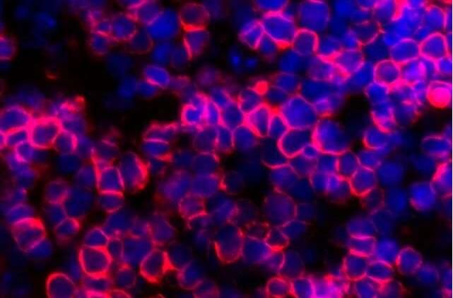 Nat Methods：新型人工胸腺可源源不断通过血液干细胞制造大量抗癌T细胞
