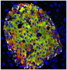Cell Metab：糖尿病研究重大突破！首次发现产生胰岛素的初始β细胞
