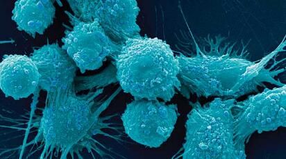 cancer res:科学家成功解析癌细胞的神秘调节机制
