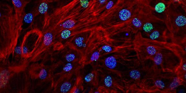 natcommun重磅科学家首次成功绘制出人类心肌细胞基因调节子蓝图