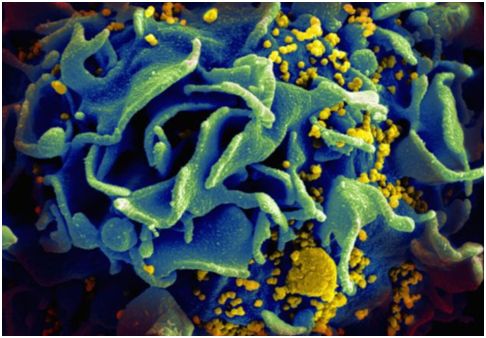 Nat Med：抗体疗法可增强HIV感染者体内的T细胞免疫反应