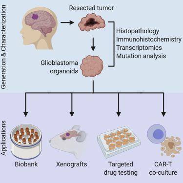 Cell：人胶质母细胞瘤类器官可重现肿瘤特征，并可用于评价药物和CAR-T细胞的疗效