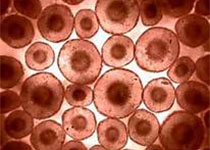 造血干细胞或为化疗提供新方向
