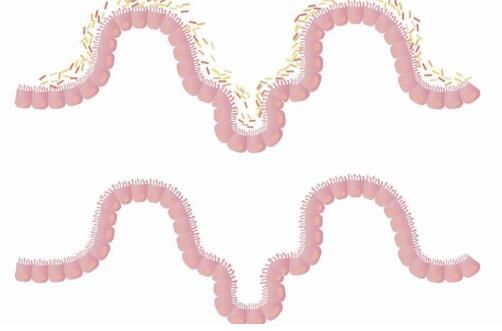 Cell子刊两篇文章揭示粪便移植治疗多种人类疾病的研究现状