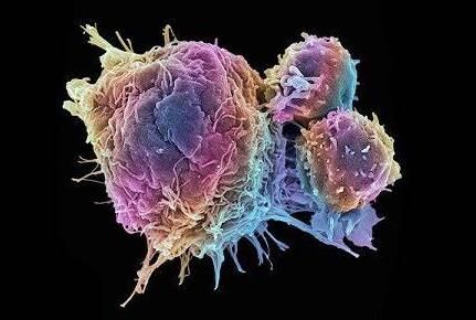 Cell Rep：科学家鉴别出两种关键的益生元 或能通过激活抗肿瘤免疫力来抵御癌症进展