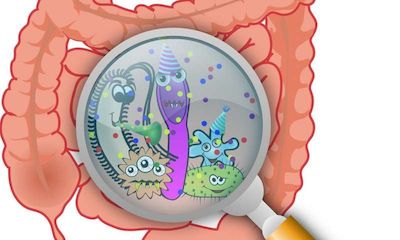 Cell Host Microbe：肠炎与肠道微生物缺失有关