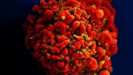 Science子刊：揭示异基因造血干细胞移植后存在HIV重新感染的脆弱窗口