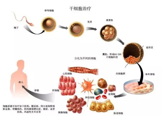 最新研究对于自体造血干细胞移植治疗多发性硬化提供了进一步的证据