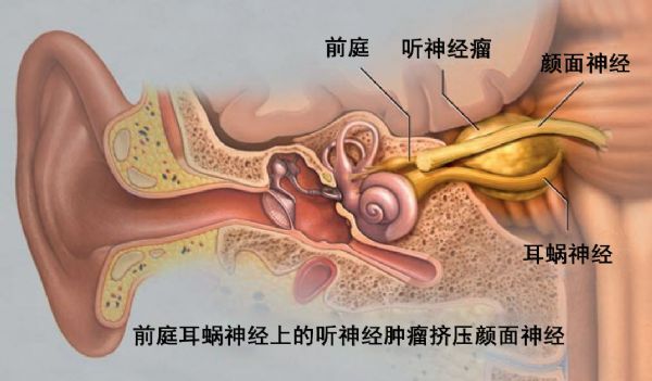 面听神经解剖图片