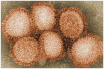 透射电镜下的h3n2病毒图片来源:美国疾病控制和预防中心