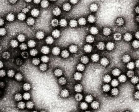PNAS:科学家成功解析诺如病毒精细化结构 有望帮助开发治疗诺如感染新疗法! - 广州振威国际展览有限公司
